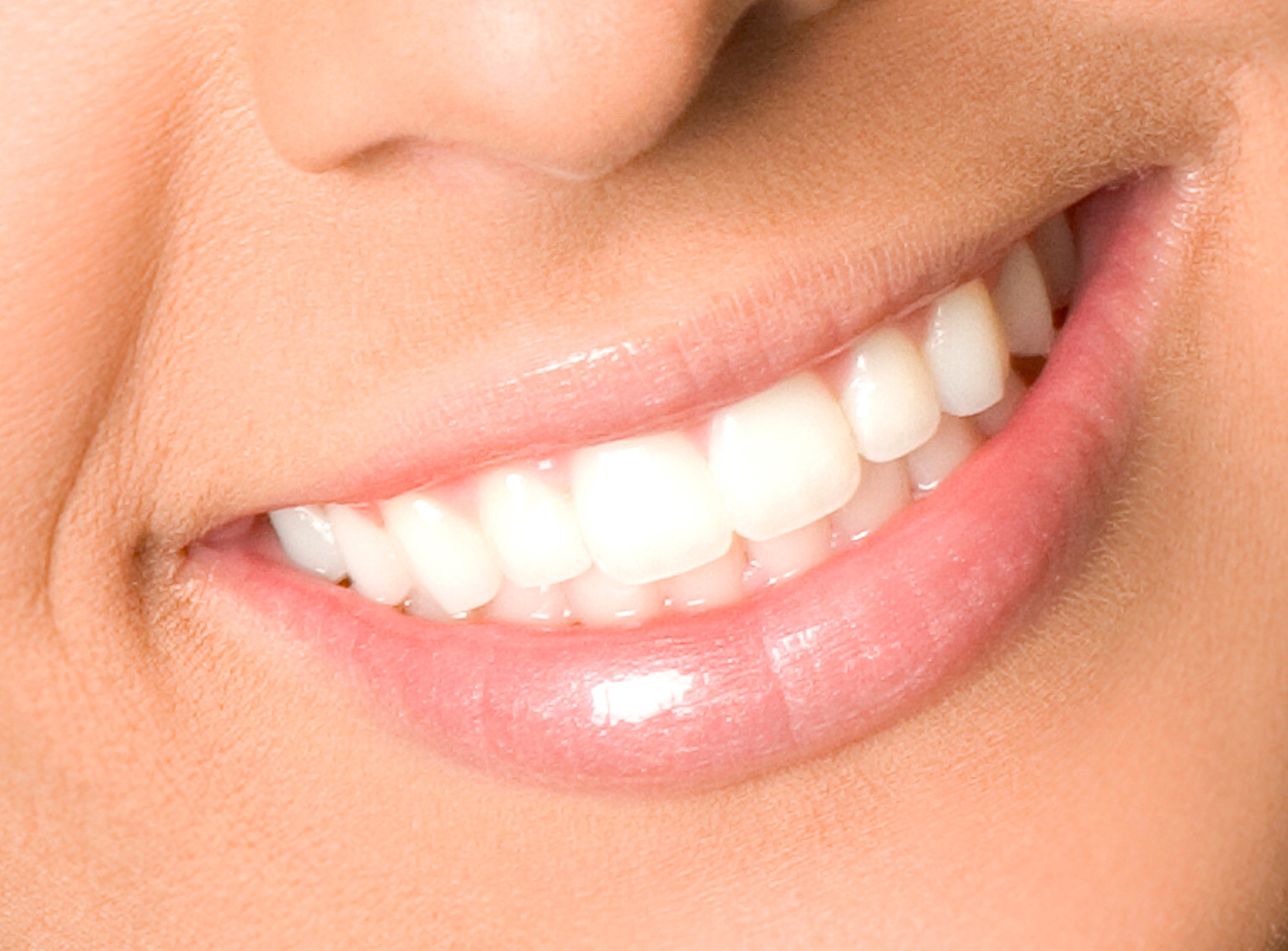 Porcelain Veneers in El Paso | Eversmile Dentist | Eversmile
